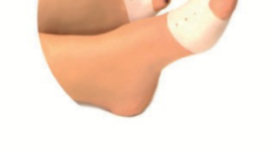 Atelli Makaralı Giyilebilir Metatarsal Pedi
